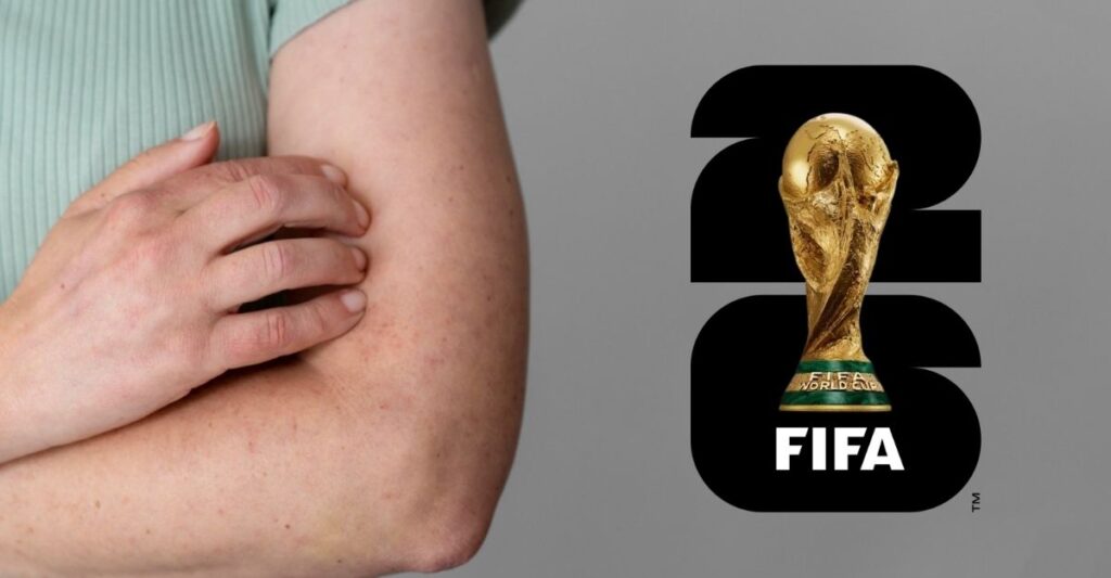 CDMX implementa vacuna obligatoria contra el sarampión rumbo al Mundial 2026